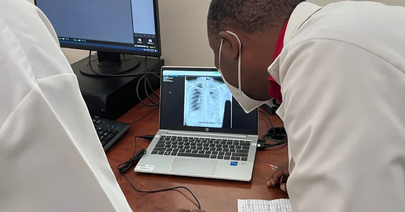 mozambique-prevalence-of-symtpmatic-tb