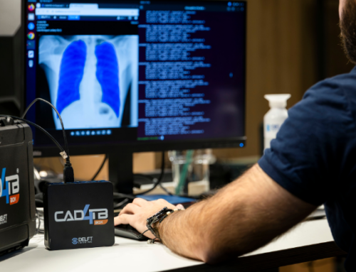 Introducing CAD4TB+: Unifying TB Detection and Surveillance